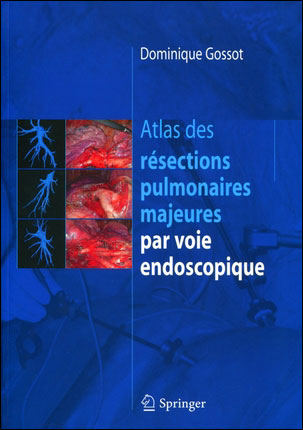Atlas des résections pulmonaires majeures par voie endoscopie