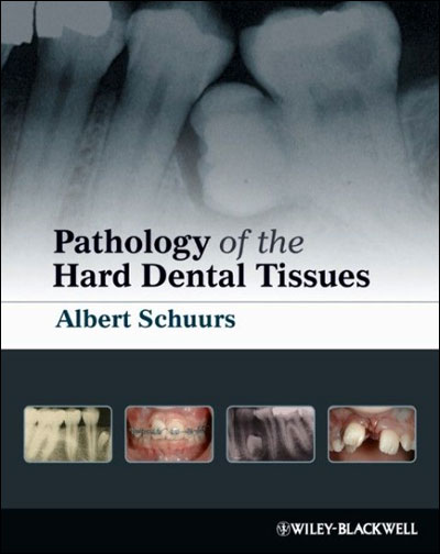 Pathology of the Hard Dental Tissues