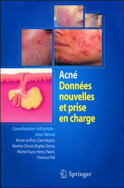 Acné