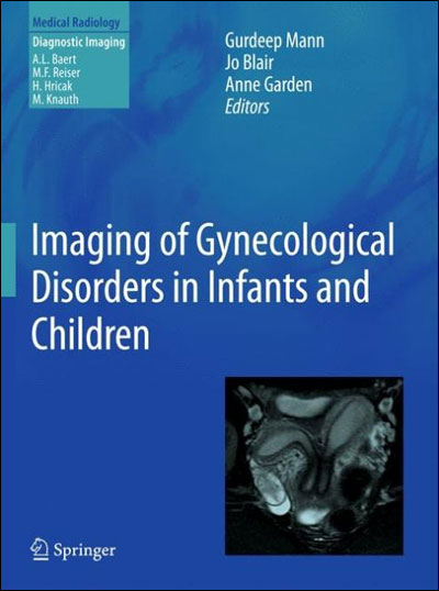 Imaging of gynecological disorders in infants and children