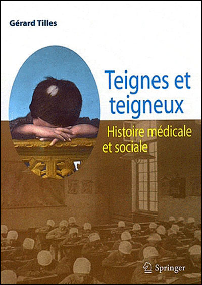 Teignes teigneux
