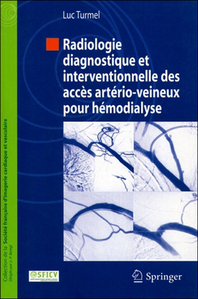Radiologie interventionnelle de l'abord vasculaire pour hémo