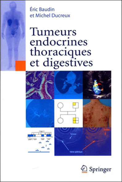 Tumeurs endocrines thoraciques et digestives