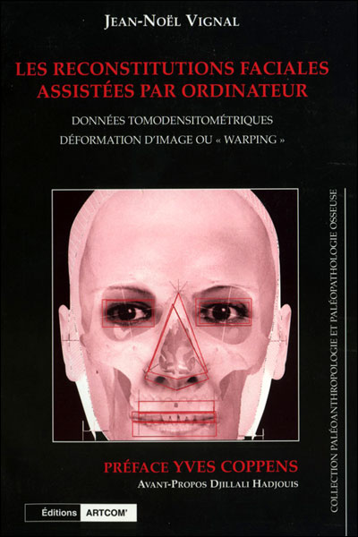 Reconstitutions faciales assistees par ordinateur