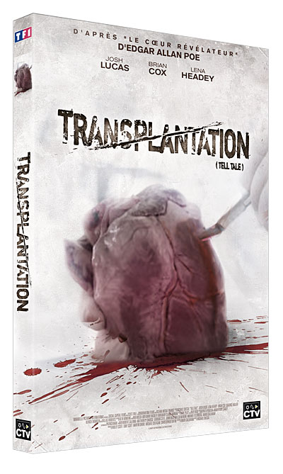 Transplantation