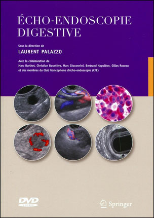 Echoendoscopie digestive