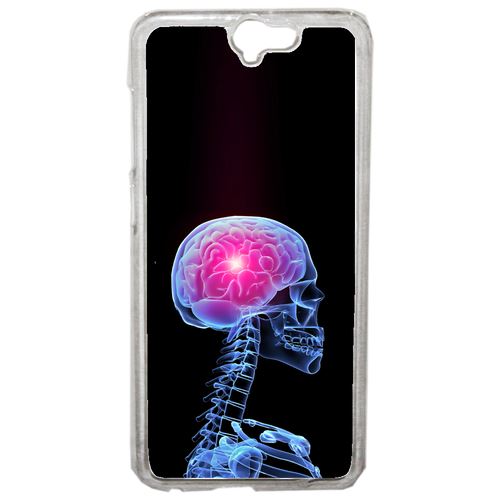 Coque Squelette 3d Cerveau Compatible One A9 Transparent
