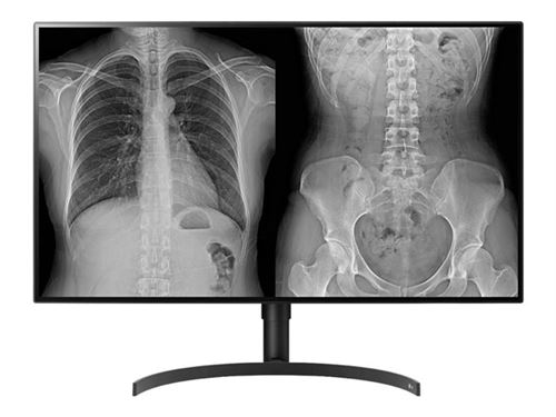 LG 32HL512D-B - LED-monitor - 8MP - kleur - 31.5 - 3840 x 2160 4K - IPS - 450 cd/m² - 1300:1 - HDR10 - 5 ms - HDMI, 2xDisplayPort