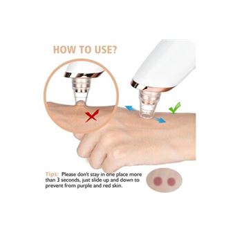 Nettoyeur électrique Points Noirs Visage – Pour Peau Mixte, élimine Pores Obstrués