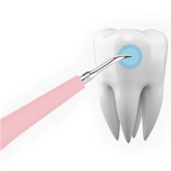 Détartreur dentaire à ultrasons connecté avec caméra HD, Soins dentaires