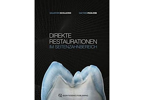 Direkte Restaurationen im Seitenzahnbereich (German Edition) Format Kindle