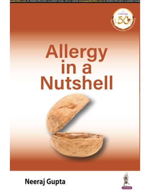 Allergy In A Nutshell (English Edition) [Print Replica] Format Kindle