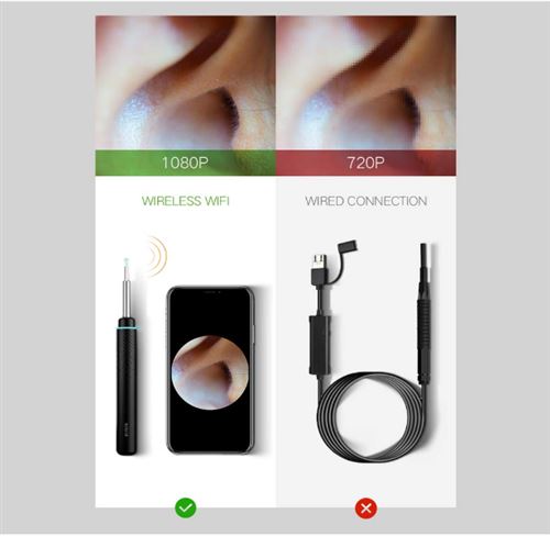 Acheter Nettoyeur d'oreille visuel intelligent sans fil, Otoscope