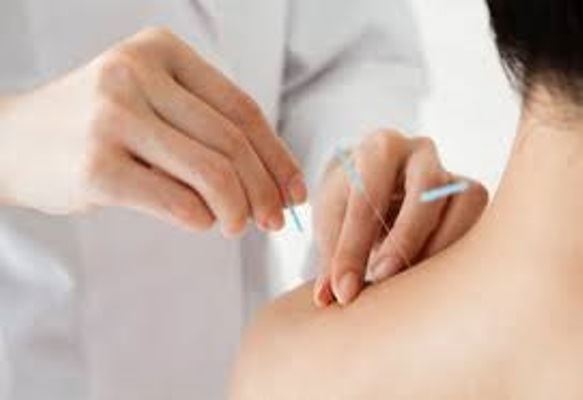 ¿Acupuntura para la fertilidad y maternidad?