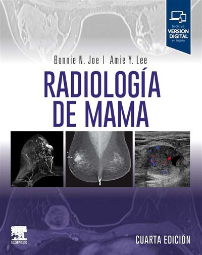 Elsevier España, S.l.u. Clara Radiología De Mama
