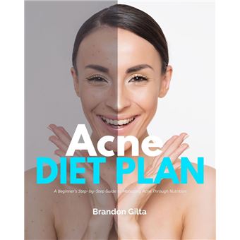 Acne Diet Plan - 1