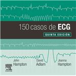 150 casos de ecg (5ª ed.)