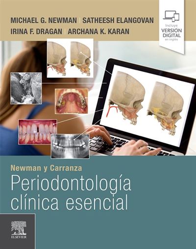 Elsevier España, S.l.u. Newman Y Carranza. Periodontología Clínica Esencial