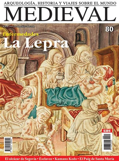 historia de la lepra