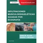 Infiltraciones musculoesqueléticas