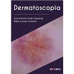Dermatoscopia