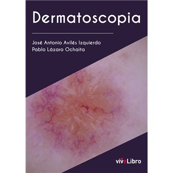 Dermatoscopia
