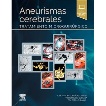 Aneurismas cerebrales