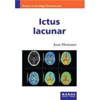 Ictus lacunar