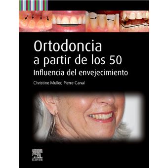 Ortodoncia a partir de los 50 - 1