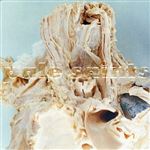 In Ribbons 30Th Anniversary - 2 Vinilos Transparente