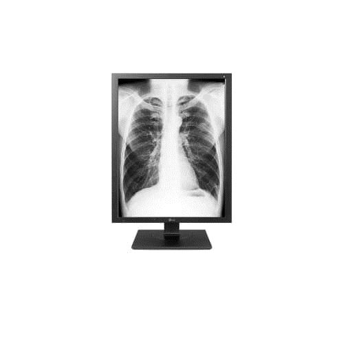 Écran PC LG 3Mp 21Hk512D 21.3 LED IPS 2K 160Hz HDMI USB Noir