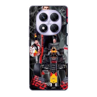 Coque Carbon Black pour Xiaomi Redmi Note 14 Pro 5G / Pro Plus 5G
