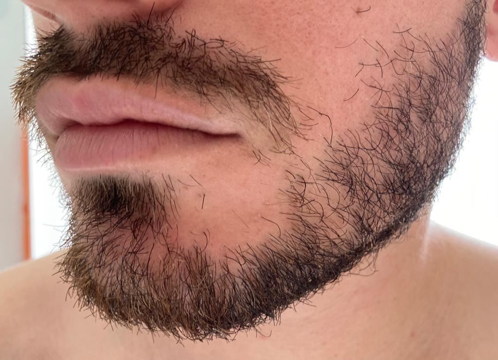 Test Philips S9000 barbe longue côté
