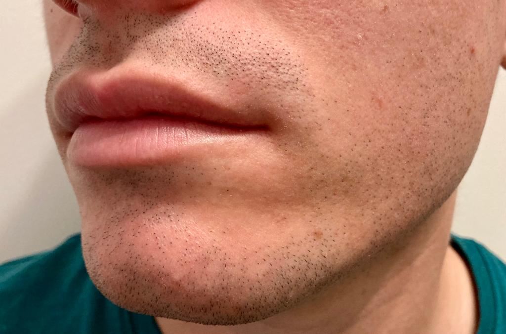 Test Philips S9000 barbe rasée côté