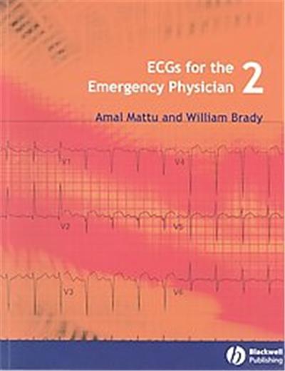ECGs for the Emergency Physician