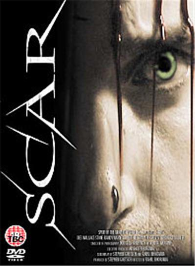 Scar