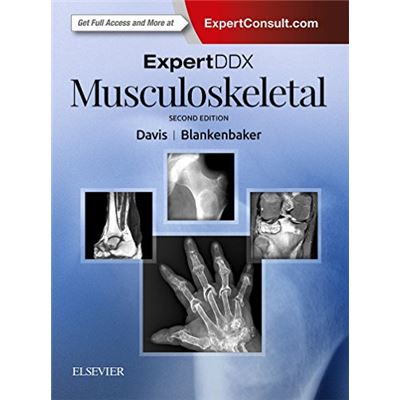 Expertddx: Musculoskeletal, 2E