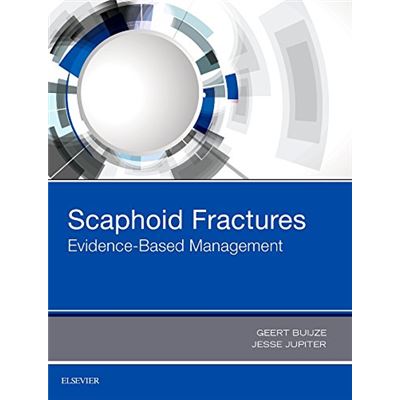 Scaphoid Fractures: Evidence-Based Management, 1E