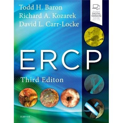 Ercp, 3E
