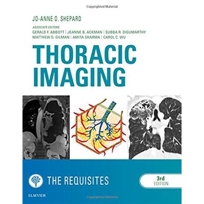 Thoracic Imaging The Requisites, 3E