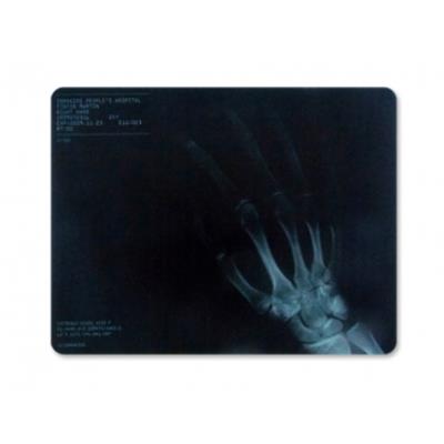 Tapis informatique radiographie main tapis de souris relief sexy fun insolite informatique