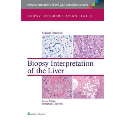 Biopsy Interpretation of the Liver - [Version Originale]