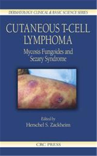Cutaneous T-Cell Lymphoma, Dermatology: Clinical & Basic Science Series