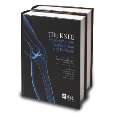 The Knee