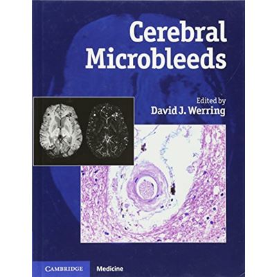 Cerebral Microbleeds: Pathophysiology to Clinical Practice David Werring
