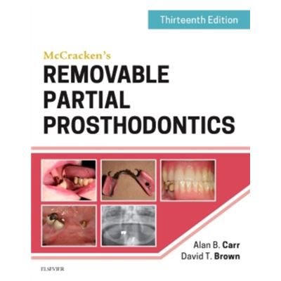 Mccracken'S Removable Partial Prosthodontics, 13E (Hardcover)