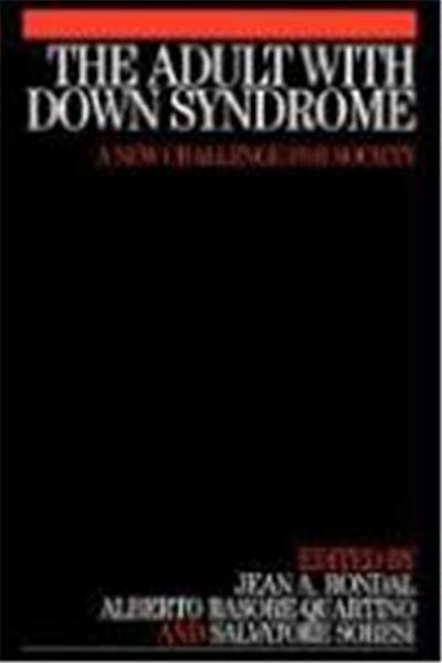 Adult with Down Syndrome