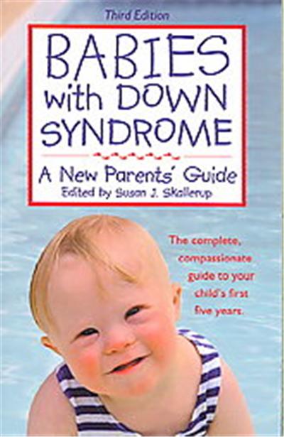 Babies With Down Syndrome