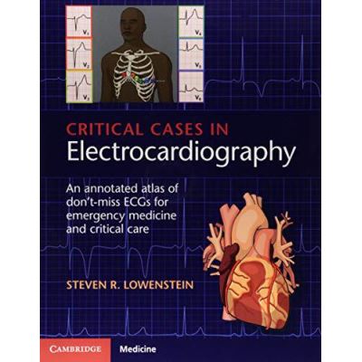 Critical Cases in Electrocardiography: An Annotated Atlas of Don't-Miss ECGs for Emergency Medicine and Critical Care - [Version Originale]