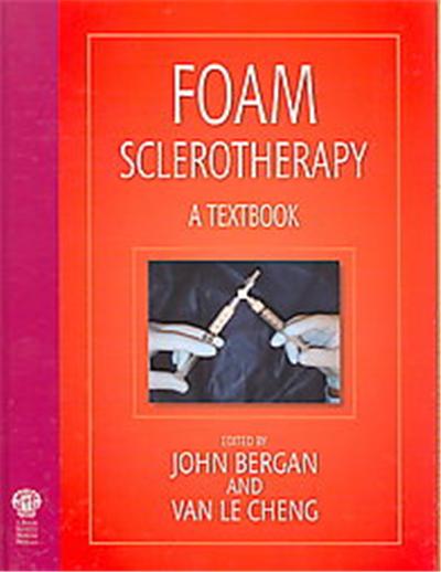 Foam Sclerotherapy